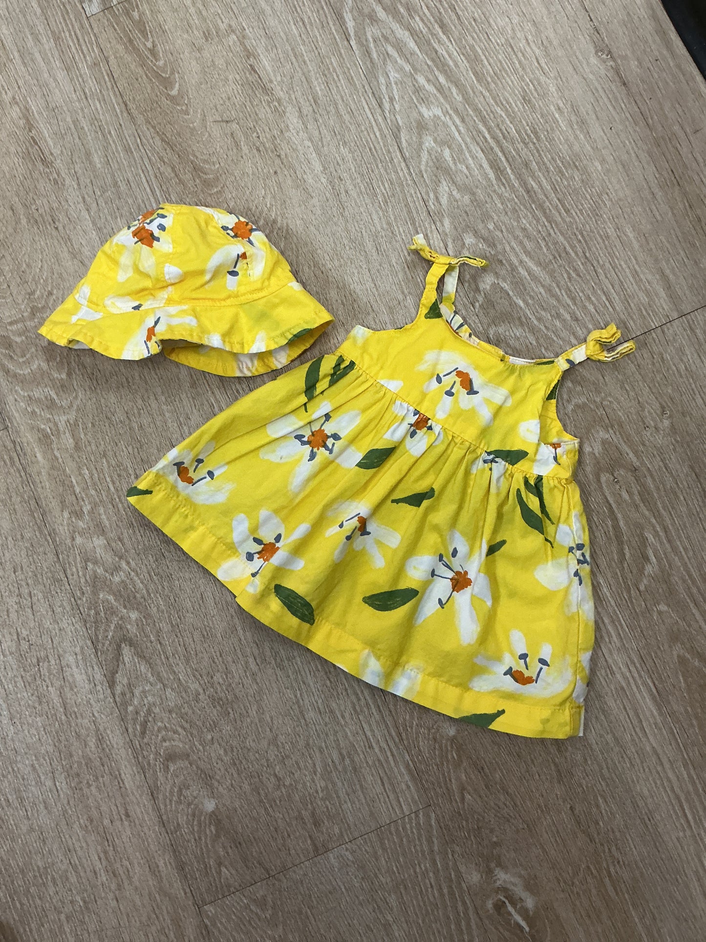 Newborn Yellow Tank Dress + Hat