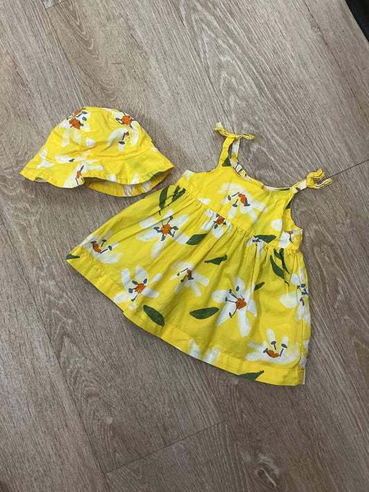 Newborn Yellow Tank Dress + Hat